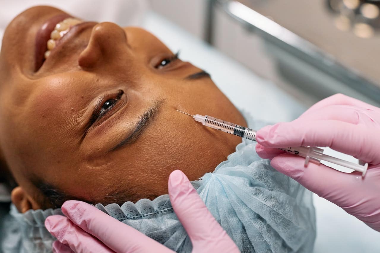 iniezione di acido ialuronico tramite filler