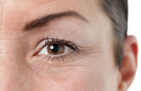 metodo per attenuare le rughe d'espressione